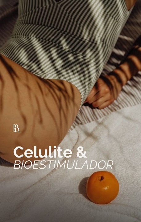 celulite e bioestimulador